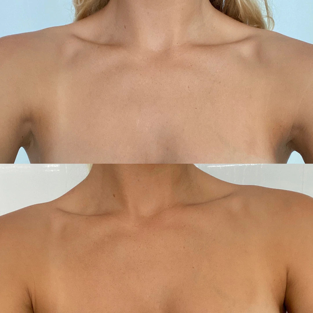 Hempitan__alykingg_Before_After_Chest_1080x