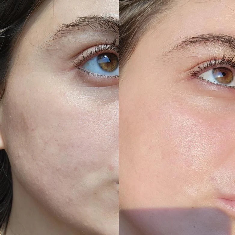 Serums